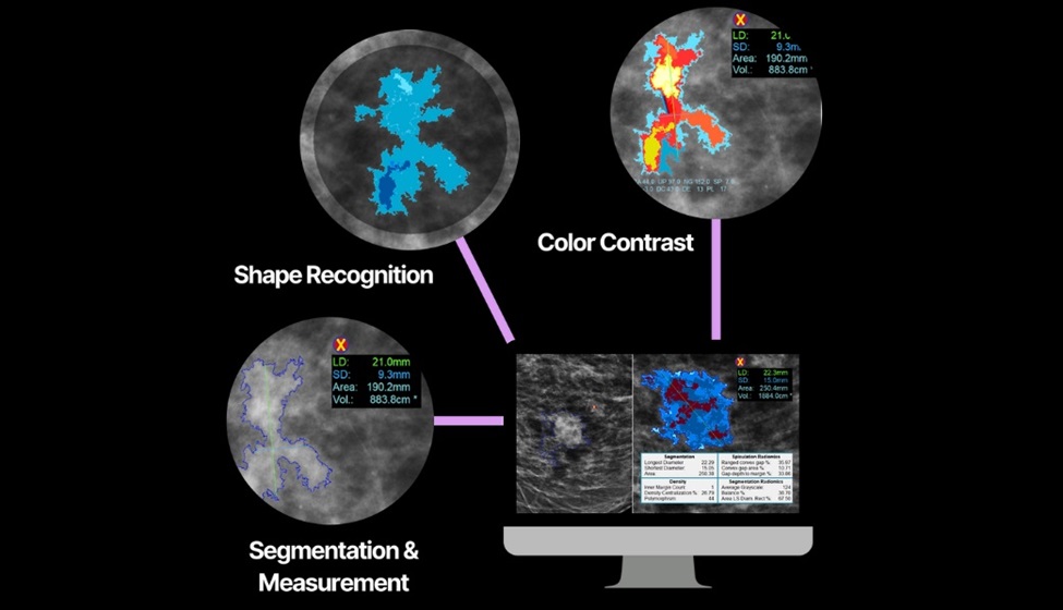 Image: The DL Precise shape-recognition software improves accuracy and efficiency in medical imaging (Photo courtesy of DeepLook Medical)